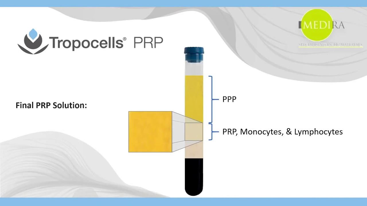 Tropocells PRP How it works смотреть онлайн