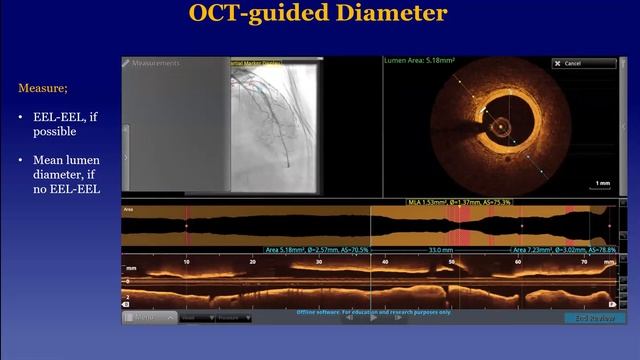An Algorithmic Approach to OCT, Dr. Kevin Croce M.D., Ph.D смотреть онлайн