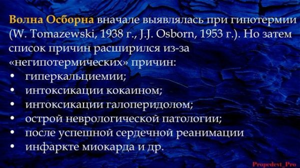 Волна Осборна или J-волна?
