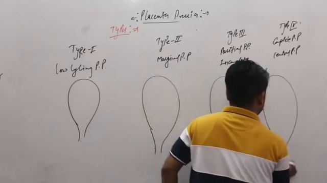 placenta previa -1 ,#obg/#by amit sir/nursing study officials смотреть онлайн