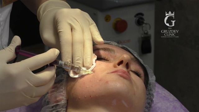 Преждевременное старение: как восстановить кожу после стресса смотреть онлайн