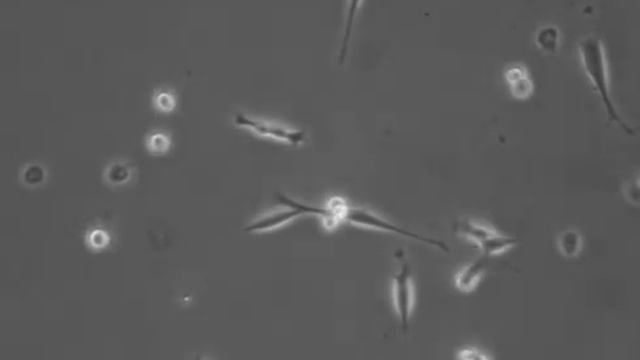 3T3 Cytokinetics Time-lapse смотреть онлайн