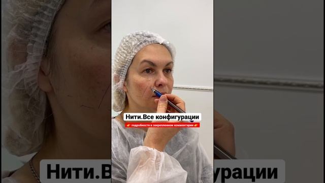 ♨️ Нитевой лифтинг обучение #косметологиямосква #обучениекосметологов #контурнаяпластика #ботокс смотреть онлайн