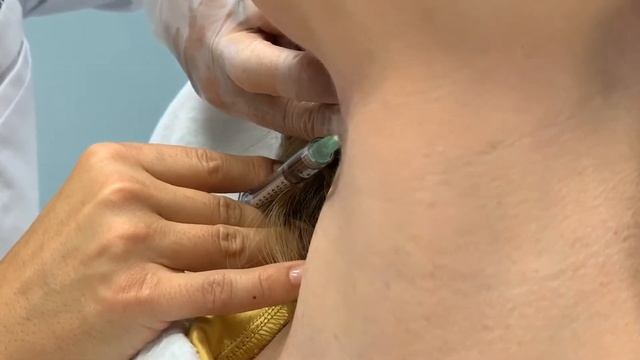 BOTOX Neck Rejuvenation for Turkey Neck Prevention and Correction смотреть онлайн