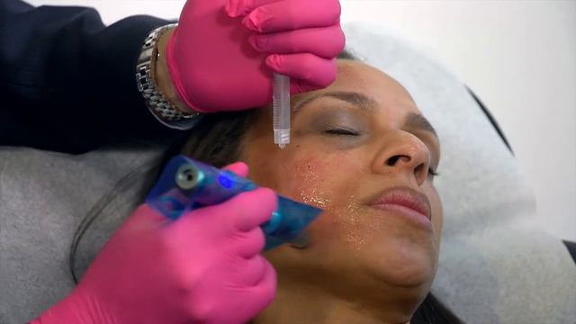 pep factor the future of aesthetic medicine 1080p смотреть онлайн