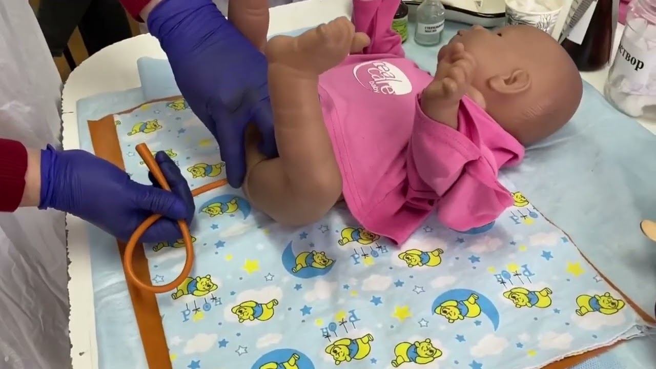 Метеоризм. Алгоритм постановки газоотводной трубки