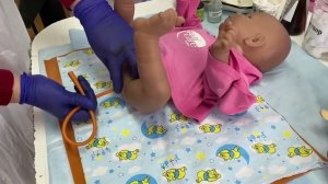 Метеоризм. Алгоритм постановки газоотводной трубки