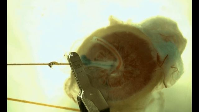 Demonstration of embolism caused by insufficient degassing of perfusate solutions смотреть онлайн