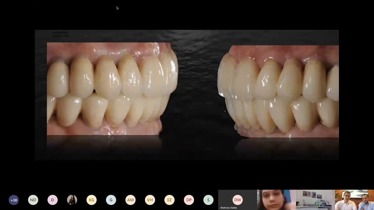 Webinar: Implant dentistry. Digital workflows Dr. G Ciabattoni & Dr. A Acocella | Alpha-Bio Tec смотреть онлайн