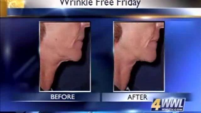 Prevent sagging skin with Titan Laser - Dr. Mary Lupo смотреть онлайн
