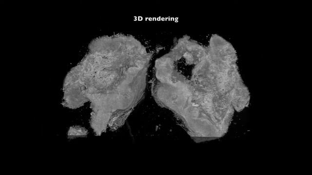 Saline-treated tumour смотреть онлайн