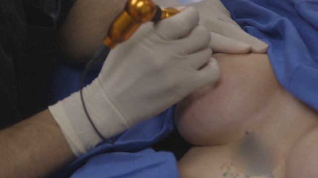 Nipple Tattoo Demo Video, Post Breast Augmentation by The Breast Implant Center of Hawaii смотреть онлайн