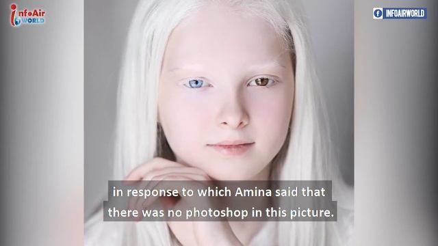 Amina Ependieva – A Chechen Girl Who Is Admired For Her Unusual Beauty смотреть онлайн