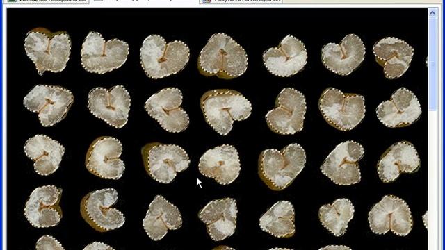 ГРАН: Стекловидность смотреть онлайн