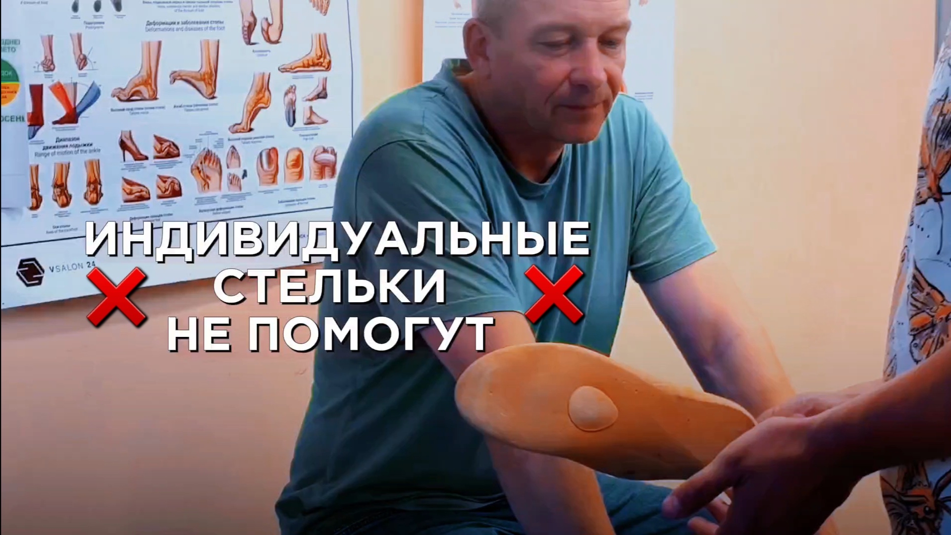 Индивидуальные стельки не помогают при плоскостопии, а лишь временно облегчают боль смотреть онлайн