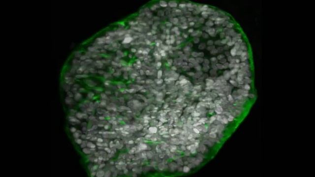 3D Projection of hPO, stained with Phalloidin 488 and DAPI in Exp. medium scale100 смотреть онлайн