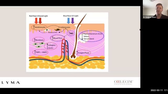 The LYMA Laser & CALECIM: Optimising Patients' Results at Home Harnessing the Power of Laser Speckl смотреть онлайн