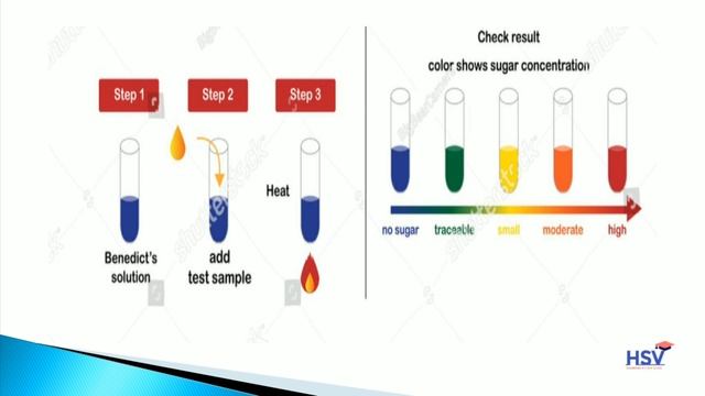 Chemical Examination of urine || Urine analysis || Glucose in urine || Glycosuria смотреть онлайн