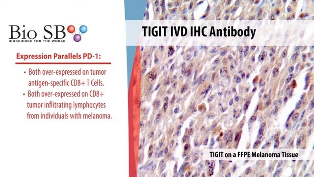 Bio SB - 2021 New TIGIT Antibody for IHC смотреть онлайн