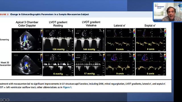 Treatment Options for HCM смотреть онлайн