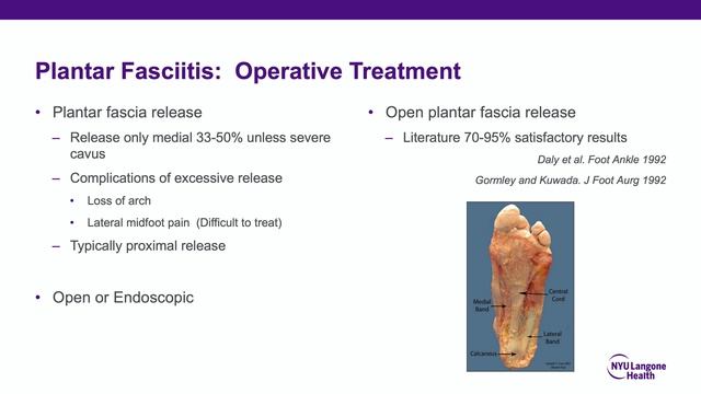 Plantar Fasciitis And Heel Pain - ABOS Orthopedic Surgery Board Exam Review
