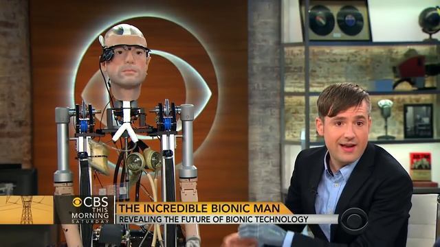 Watch: The world's first fully-functional bionic man смотреть онлайн