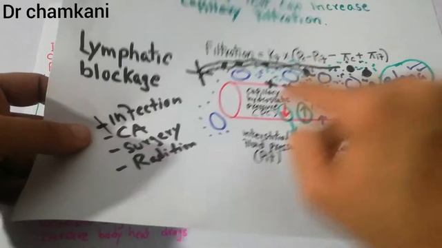 Renal physiology 24 | Causes of extracellular edema | Increased capillary pressure | low proteins смотреть онлайн