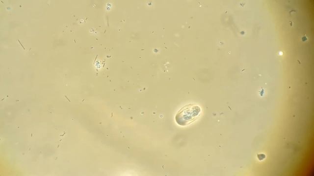 Amoeba phase contrast смотреть онлайн