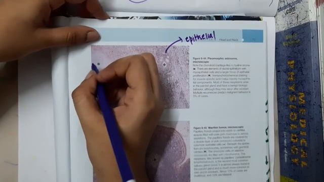 Pleomorphic Adenoma Microscopic mp4 смотреть онлайн