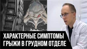 Защемление нервов в грудном отделе. Особенности проявлений и лечения грыж грудного отдела