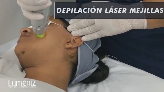 DEPILACIÓN LÁSER MEJILLAS смотреть онлайн