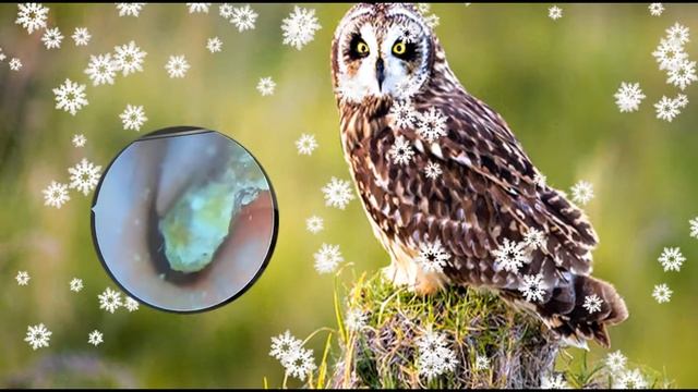 Ear Wax Removal Eps#130 || чистка ушной серы #130 смотреть онлайн