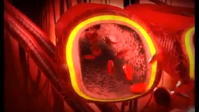 Best treatment for heart patient part 2 L arginine hindi смотреть онлайн