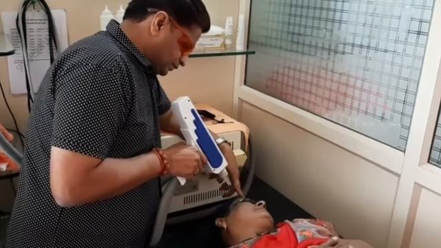 Q Switch Yag Laser treatment on Melasma | Dr Bhutada LASER India смотреть онлайн