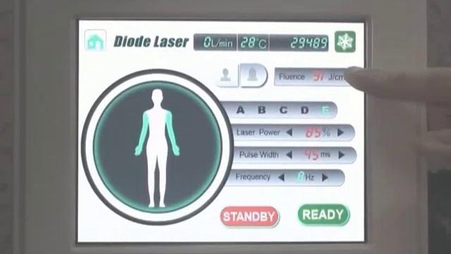 New 3waves Diode laser смотреть онлайн