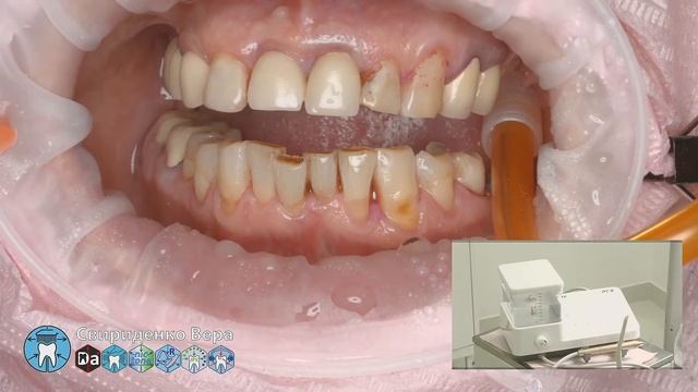 Professional Dental Hygiene DTE PT5 (FHD multistream) смотреть онлайн