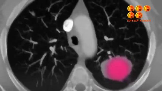 Вкусно пахнущий дым с ядовитой начинкой. смотреть онлайн