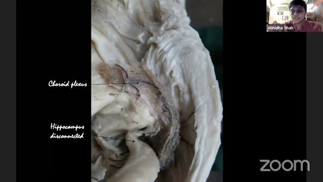 Neuroanatomy TV Opening September 28, 2020 смотреть онлайн