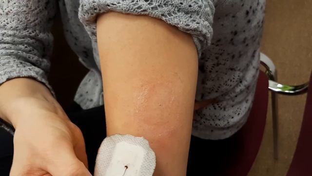 ЯК САМОСТІЙНО ЗНІМАТИ СЕНСОР СИСТЕМИ ПОСТІЙНОГО МОНІТОРИНГУ ГЛЮКОЗИ В КРОВІ POCTech? смотреть онлайн