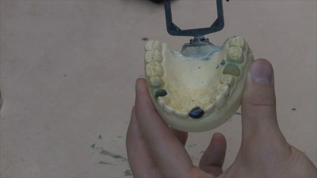 Incisor Wax-Up смотреть онлайн