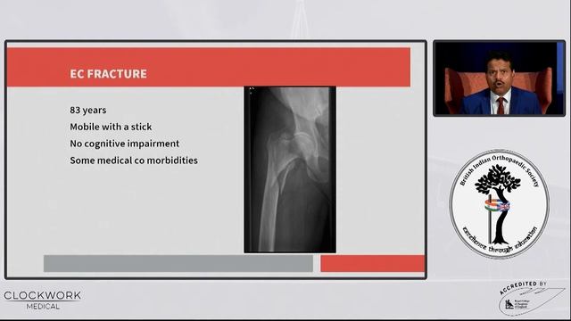 Hip Fracture Update смотреть онлайн