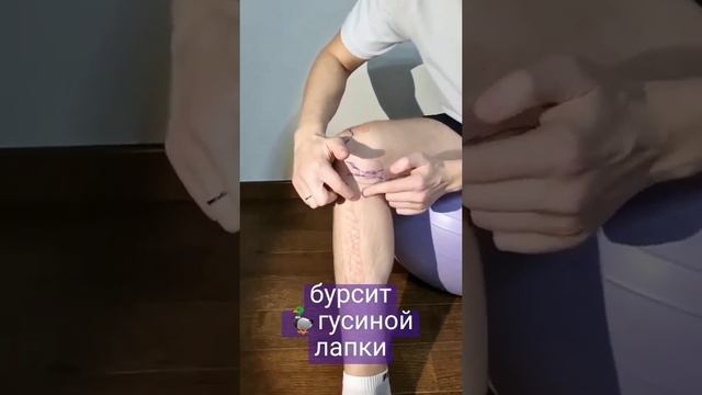 Диагностика боли. Колено. Часть 1.