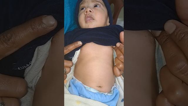 Assessment of ARI as per IMNCI #pneumonia #bronchiolitis #cough #fever #kids #who #viral смотреть онлайн