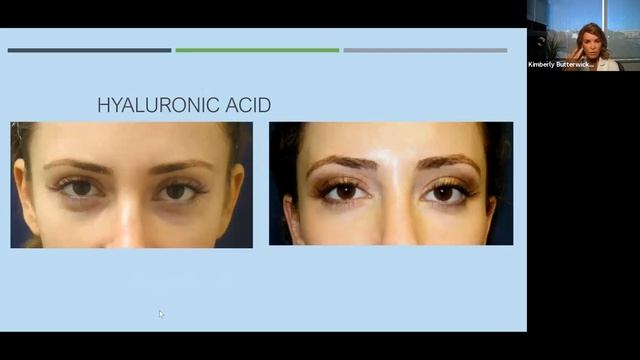 Facial Beauty Above The Mask: Eye & Forehead Rejuvenation | Cosmetic Laser Dermatology Webinar
