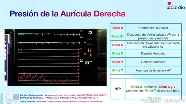 Cómo hacer un cateterismo derecho смотреть онлайн