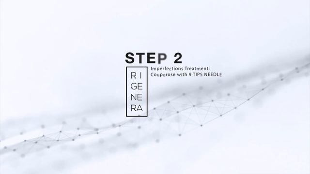 RIGENERA needling смотреть онлайн