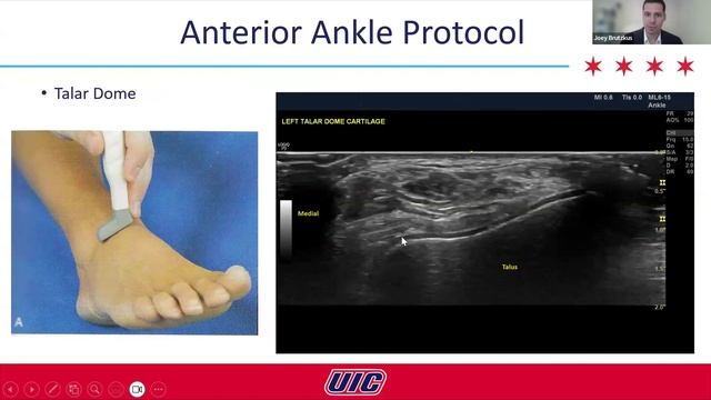AITFL Sprain with Dr. Joseph Brutzkus | AMSSM Sports Ultrasound Case Presentation смотреть онлайн