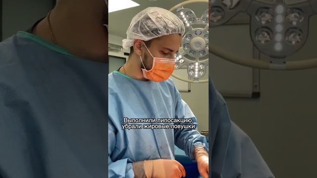 Восстановить фигуру после родов. Пластика живота, увеличение ягодиц, липосакция смотреть онлайн