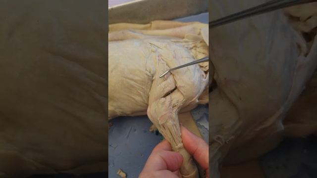 upperforlimbmuscles.mp4 смотреть онлайн