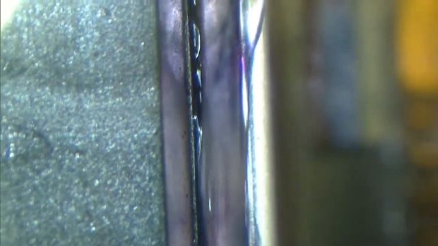 Epi-LASIK Treatment смотреть онлайн